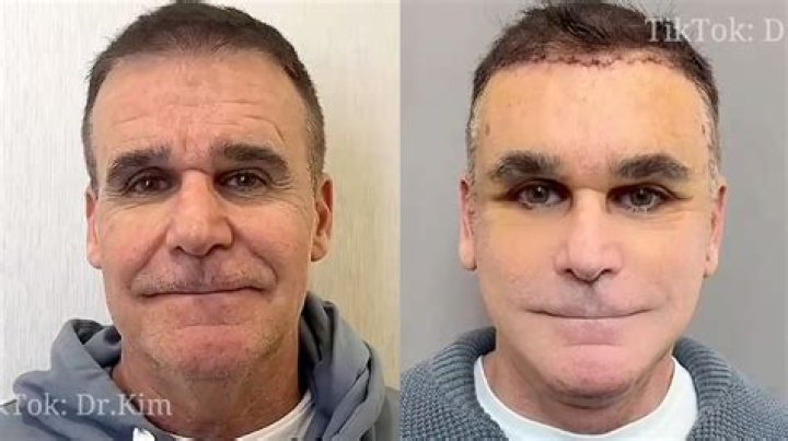 Brittany Furlan | Plastic Surgery Viral On Tiktok: Before