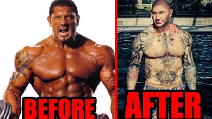 Dave Bautista | Plastic Surgery Before And After