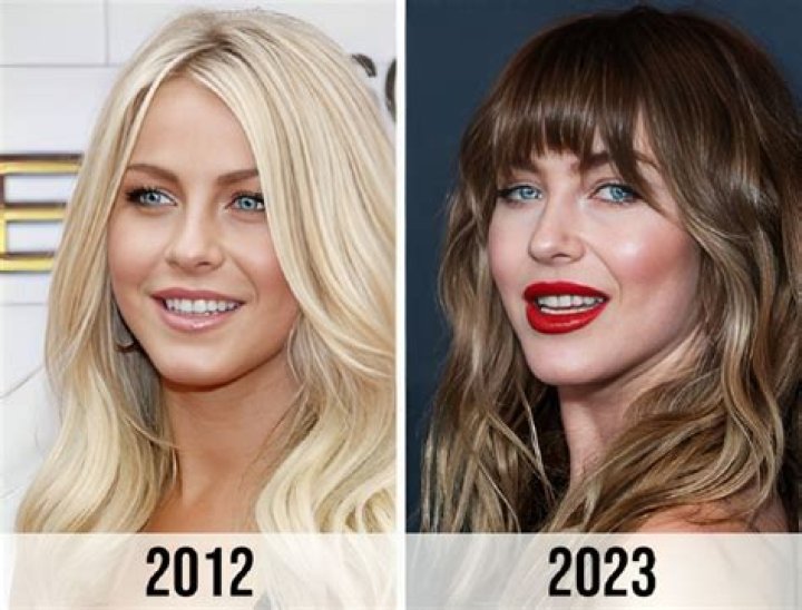 Julianne Hough | Weight Loss Journey Before And After Photos