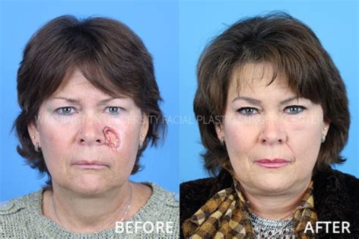 Nancy Mace Health 2023 | Plastic Surgery Before And After