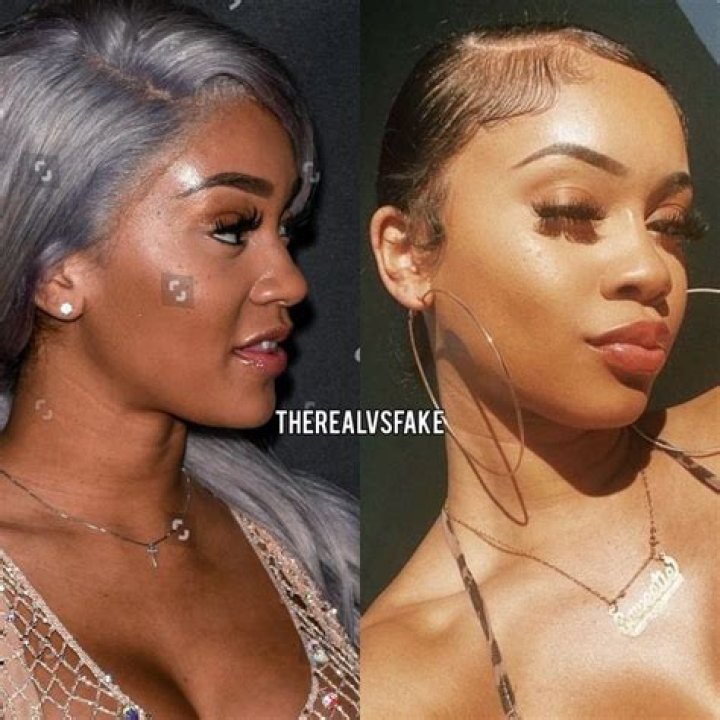 Nikita Dragun Bottom Surgery | Before And After Photos