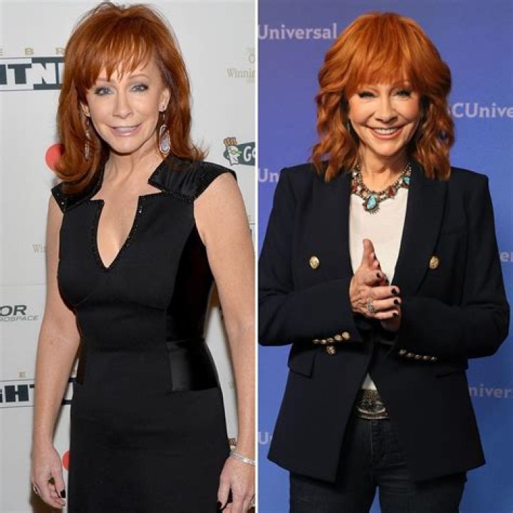 Reba Mcentire Plastic Surgery: Before And After Photo