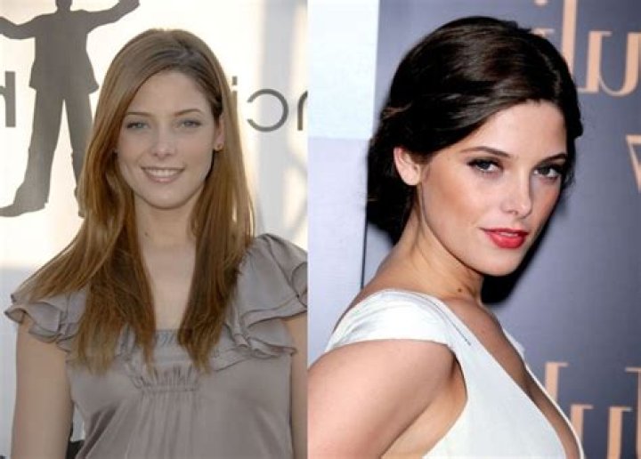 Rumors About Ashley Greene’s Plastic Surgery