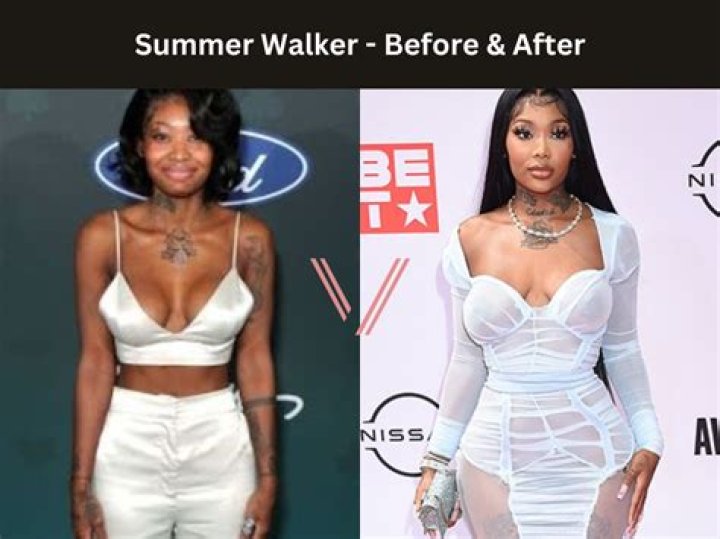 Tiwa Savage BBL Surgery | Before And After Photos