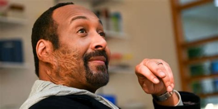 What Caused Jesse L Martin Face Scar | Health Update 2023